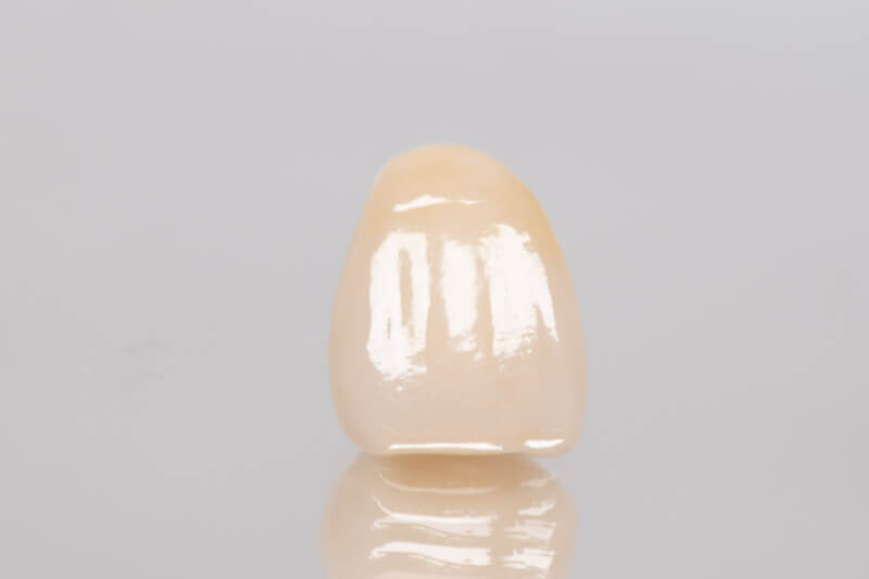 CEREC Blocs